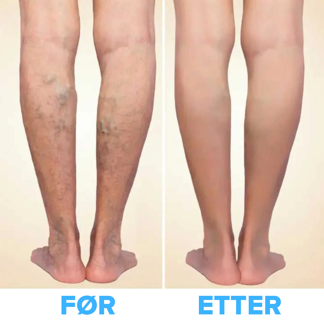 FlowSocks™ - Støttesokker